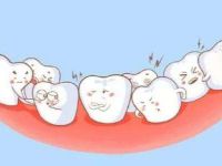 虎牙是什么?虎牙必须要拔掉吗?虎牙矫正的方法有哪些?