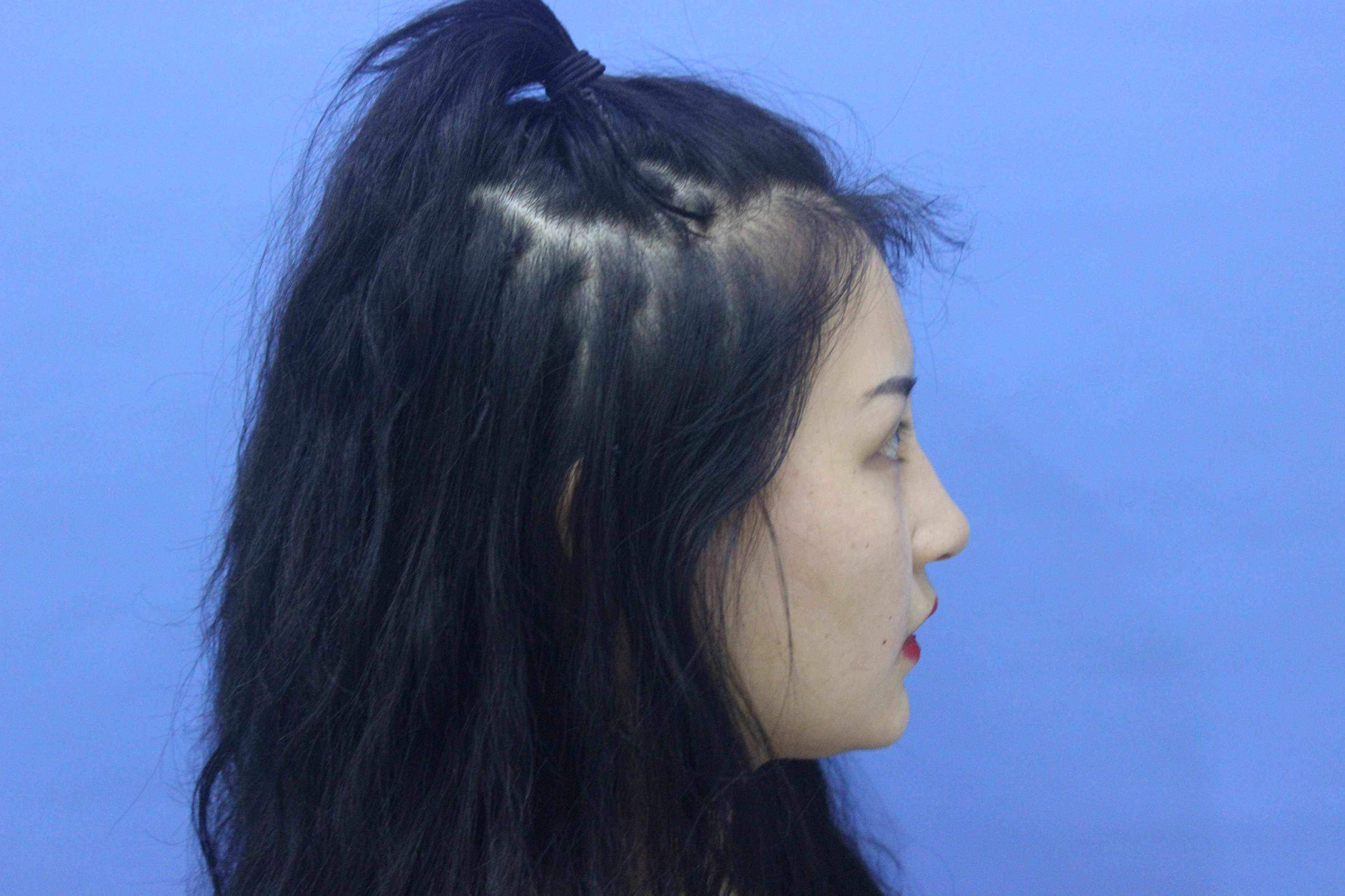 北京三甲医院鼻综合哪个最好?