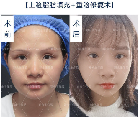 修复眼部的十大专家哪个技术最好?