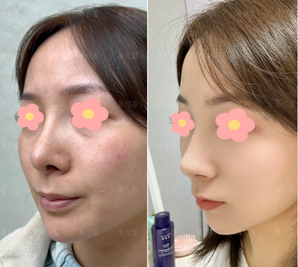 全国鼻修复医生技术和审美哪个比较好?